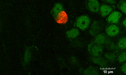 BrdU NeuN confocal image