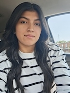 a woman in a striped shirt looks at the camera.