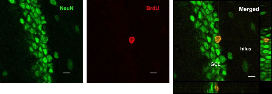 Laboratory depiction of adult neurogenesis.