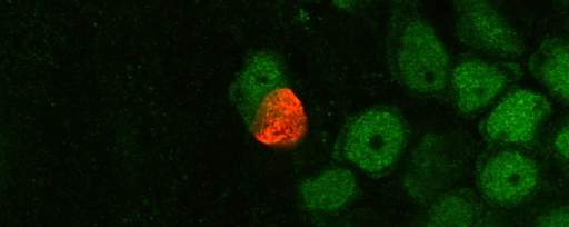 BrdU NeuN confocal image