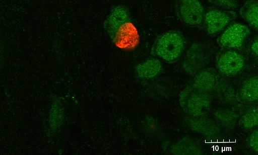 BrdU NeuN confocal image