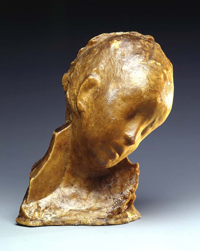 Medardo Rosso, Bimbo malato