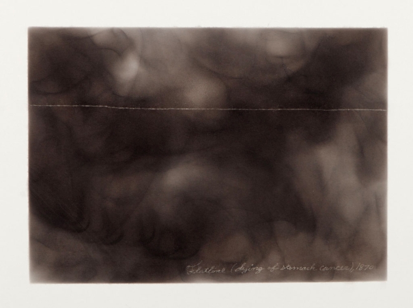 a smoky image including a flat pulse line across the field of view